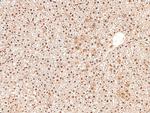 Phospho-RET (Tyr1015) Antibody in Immunohistochemistry (Paraffin) (IHC (P))