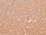 Phospho-BRCA1 (Ser1387) Antibody in Immunohistochemistry (Paraffin) (IHC (P))