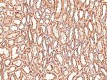 Phospho-LRP1 (Ser4520) Antibody in Immunohistochemistry (Paraffin) (IHC (P))