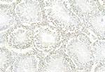 Phospho-ERK1/ERK2 (Thr202, Tyr204, Thr185, Tyr187) Antibody in Immunohistochemistry (Paraffin) (IHC (P))