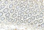 Phospho-ERK1/ERK2 (Thr202, Tyr204, Thr185, Tyr187) Antibody in Immunohistochemistry (Paraffin) (IHC (P))