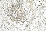 Phospho-ERK1/ERK2 (Thr202, Tyr204, Thr185, Tyr187) Antibody in Immunohistochemistry (Paraffin) (IHC (P))