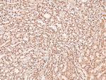 Phospho-ERK1/ERK2 (Thr202, Tyr204, Thr185, Tyr187) Antibody in Immunohistochemistry (Paraffin) (IHC (P))