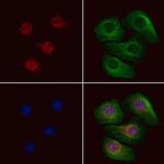 Phospho-Trf2 (Thr188) Antibody in Immunocytochemistry (ICC/IF)