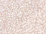 Phospho-FGFR Pan (Tyr653, Tyr654) Antibody in Immunohistochemistry (Paraffin) (IHC (P))