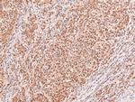 Phospho-alpha Dystroglycan (Tyr892) Antibody in Immunohistochemistry (Paraffin) (IHC (P))