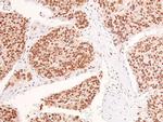 Phospho-EphB1/EphB3/EphB4 (Tyr778, Tyr792, Tyr774) Antibody in Immunohistochemistry (Paraffin) (IHC (P))