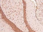 Phospho-EphB1/EphB3/EphB4 (Tyr778, Tyr792, Tyr774) Antibody in Immunohistochemistry (Paraffin) (IHC (P))