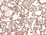 Phospho-EphB1/EphB3/EphB4 (Tyr778, Tyr792, Tyr774) Antibody in Immunohistochemistry (Paraffin) (IHC (P))