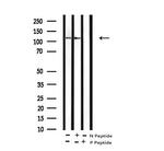 Phospho-EphB1/EphB3/EphB4 (Tyr778, Tyr792, Tyr774) Antibody in Western Blot (WB)