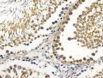 Phospho-Leptin Receptor (Tyr1141) Antibody in Immunohistochemistry (Paraffin) (IHC (P))