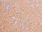 Phospho-FGFR1/FGFR2 (Tyr730, Tyr733) Antibody in Immunohistochemistry (Paraffin) (IHC (P))