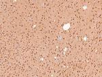 Phospho-IFNAR1 (Ser535) Antibody in Immunohistochemistry (Paraffin) (IHC (P))