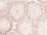 Phospho-Connexin 43 (Ser282) Antibody in Immunohistochemistry (Paraffin) (IHC (P))