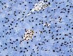 Phospho-Androgen Receptor (Tyr535) Antibody in Immunohistochemistry (Paraffin) (IHC (P))