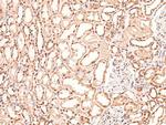 Phospho-BAG3 (Tyr457) Antibody in Immunohistochemistry (Paraffin) (IHC (P))