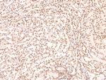 Phospho-BAG3 (Tyr457) Antibody in Immunohistochemistry (Paraffin) (IHC (P))