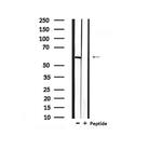 Phospho-BAG3 (Tyr457) Antibody in Western Blot (WB)