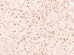 Phospho-Bim (Ser44, Ser104) Antibody in Immunohistochemistry (Paraffin) (IHC (P))