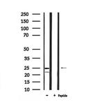 Phospho-Bim (Ser44, Ser104) Antibody in Western Blot (WB)