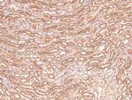 Phospho-Claudin 1 (Tyr210) Antibody in Immunohistochemistry (Paraffin) (IHC (P))