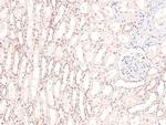 Phospho-CRMP1 (Tyr504) Antibody in Immunohistochemistry (Paraffin) (IHC (P))