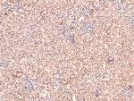 Phospho-CRMP1 (Tyr504) Antibody in Immunohistochemistry (Paraffin) (IHC (P))