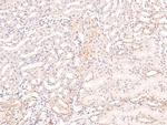 Phospho-CRMP1 (Tyr504) Antibody in Immunohistochemistry (Paraffin) (IHC (P))