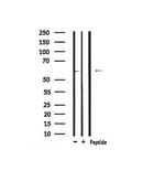 Phospho-CRMP1 (Tyr504) Antibody in Western Blot (WB)