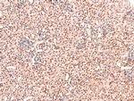 Phospho-CUX1 (Ser1237) Antibody in Immunohistochemistry (Paraffin) (IHC (P))