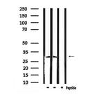 Phospho-Cyclin D1 (Thr288) Antibody in Western Blot (WB)