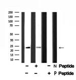 Phospho-RCAN1 (Ser163) Antibody in Western Blot (WB)