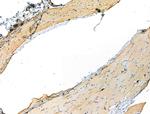 Phospho-RCAN1 (Ser163) Antibody in Immunohistochemistry (Paraffin) (IHC (P))