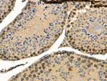 Phospho-c-Fos (Ser374) Antibody in Immunohistochemistry (Paraffin) (IHC (P))