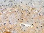 Phospho-c-Fos (Ser374) Antibody in Immunohistochemistry (Paraffin) (IHC (P))