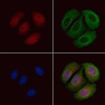 Phospho-FOXO1 (Ser249) Antibody in Immunocytochemistry (ICC/IF)