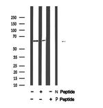 Phospho-MAP2 (Ser136) Antibody in Western Blot (WB)