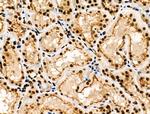 Phospho-MKP-1 (Ser323) Antibody in Immunohistochemistry (Paraffin) (IHC (P))