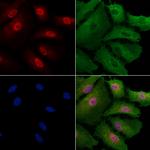 Phospho-NFATC1 (Ser172) Antibody in Immunocytochemistry (ICC/IF)