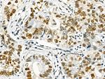 Phospho-NFATC1 (Ser172) Antibody in Immunohistochemistry (Paraffin) (IHC (P))