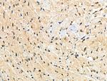 Phospho-p21 (Ser130) Antibody in Immunohistochemistry (Paraffin) (IHC (P))