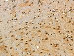 Phospho-p21 (Ser130) Antibody in Immunohistochemistry (Paraffin) (IHC (P))