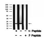 Phospho-p21 (Ser130) Antibody in Western Blot (WB)