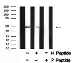 Phospho-PTP1B (Tyr66) Antibody in Western Blot (WB)