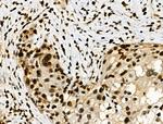 Phospho-RAD17 (Ser646) Antibody in Immunohistochemistry (Paraffin) (IHC (P))