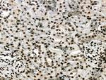 Phospho-RAD17 (Ser646) Antibody in Immunohistochemistry (Paraffin) (IHC (P))