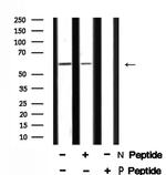 Phospho-SMAD4 (Thr277) Antibody in Western Blot (WB)