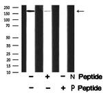 Phospho-SRC1 (Thr1179) Antibody in Western Blot (WB)