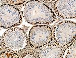 Phospho-TPPP (Ser18) Antibody in Immunohistochemistry (Paraffin) (IHC (P))