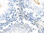 Phospho-TPPP (Ser18) Antibody in Immunohistochemistry (Paraffin) (IHC (P))